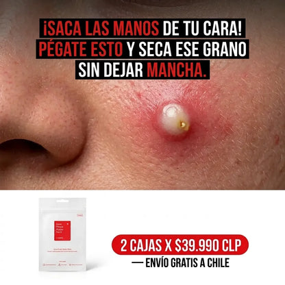 NoxPatch  "Acuéstate con un brote activo, despierta con la piel lisa y libre de pus."