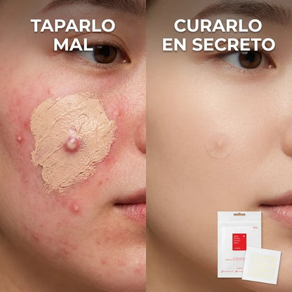 NoxPatch  "Acuéstate con un brote activo, despierta con la piel lisa y libre de pus."